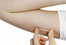 Implante contraceptivo e chip hormonal: conheça e entenda as diferenças