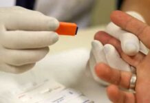 Em um ano, Covid já matou mais brasileiros do que a Aids em quase quatro décadas