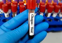Tratamento para a doença de Chagas pode ser eficaz contra a Covid-19