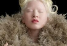 Abandonada quando nasceu por ser diferente, Xueli é agora modelo da Vogue