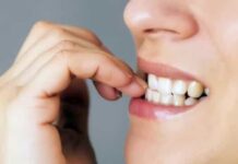 Cinco truques infalíveis para deixar de roer as unhas