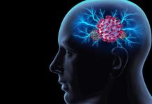 Entenda como a Covid-19 causa demência semelhante a Alzheimer