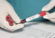 HIV: estudo mostra resistência de mutação a remédio usado no Brasil