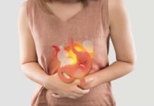 Sofre de azia? Fique longe destes alimentos!