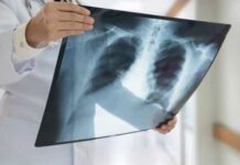 Estudo identifica pela 1ª vez infecção pulmonar causada pelo coronavírus em feto
