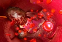 Vírus que ataca planta evita câncer metastático em teste com roedores