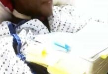 Mulher não vacinada tem os braços amputados devido à Covid-19