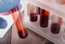 Anvisa atualiza critérios para seleção de doadores de sangue na pandemia