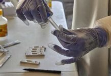 Brasil registrou 314 mortes e 54,22 mil novos casos em 24 horas