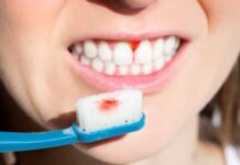 Atenção: Estas pessoas estão em maior risco de doença gengival