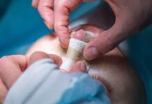 Homem é hospitalizado após tentar a viral "rinoplastia caseira"