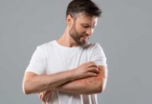 Tem dermatite atópica? Saiba que alimentos e bebidas não deve consumir