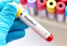 Hepatite C. Médica pede "intensificação do rastreio" em grupos de risco