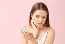 Alerta: Acne pode ser confundida com outras doenças de pele