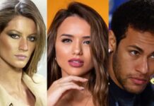 Não é só você: famosos que sofreram com a acne!