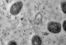 Jovem que morreu de Mpox ficou 50 dias sem remédio