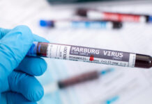Vírus de Marburg, um dos mais letais do mundo, tem surto confirmado pela OMS