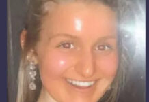 Mulher viciada em cenouras fica com pele laranja