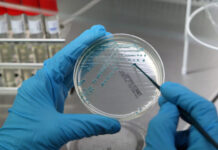 Identificada proteína com possíveis implicações na demência
