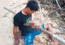 Rapaz fica com tronco atravessado no peito após acidente de moto