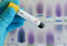 Carga viral durante infecção por HIV determina evolução do vírus
