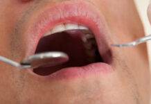 Justiça determina regras para uso de anestesia por dentistas