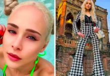 Influencer que fez cirurgia para aumentar pernas revela dores crônicas