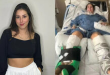 Hospital pagará volta de brasileira que teve paralisia ao contrair bactéria