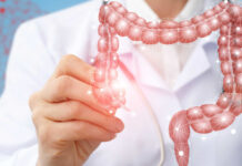 Câncer de intestino é o terceiro tumor mais recorrente no Brasil