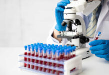 Novo teste de sangue pode determinar risco de AVC