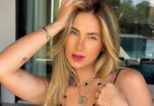 Virginia Fonseca retira hérnia umbilical e passa por mastopexia