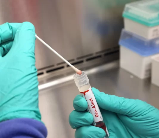 Casos de mpox mais que dobram em 20 dias, com 129 confirmações no Brasil