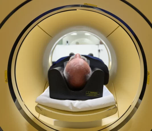 Alzheimer é a segunda doença mais temida pelos brasileiros, atrás apenas do câncer