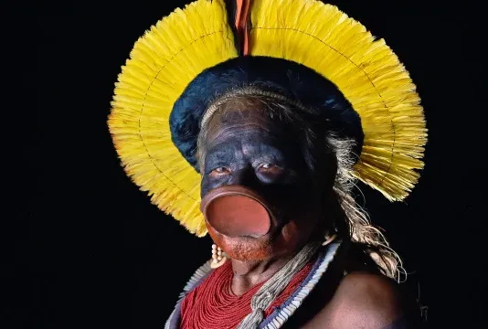 Cacique Raoni tem ‘evolução clínica favorável’, mas segue na UTI