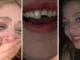 Jovem quebra dente na balada no PR, cola na madrugada e volta para a festa